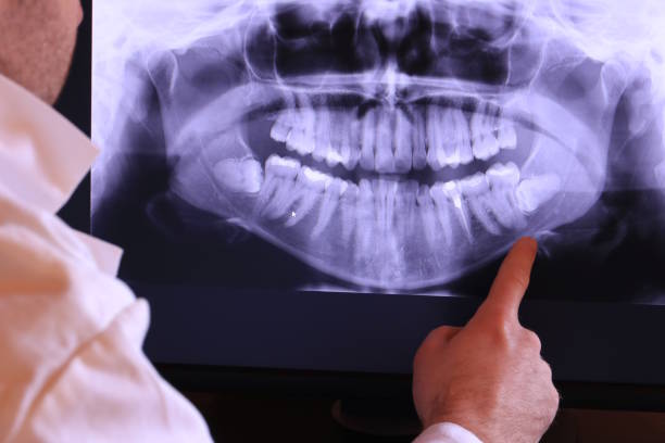 Best Orthodontic Emergency Dentist in Beltsville, MD
